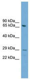 Regulator Of G Protein Signaling 18 antibody, TA329546, Origene, Western Blot image 