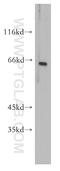 Forkhead Box G1 antibody, 12764-1-AP, Proteintech Group, Western Blot image 
