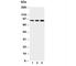 Toll Like Receptor 2 antibody, R31371, NSJ Bioreagents, Western Blot image 