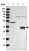 Cerberus 1, DAN Family BMP Antagonist antibody, NBP1-88030, Novus Biologicals, Western Blot image 