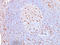 CD68 Molecule antibody, AM50195PU-T, Origene, Immunohistochemistry paraffin image 