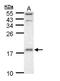 Ubiquitin Conjugating Enzyme E2 D1 antibody, NBP1-32734, Novus Biologicals, Western Blot image 