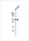 Stathmin 4 antibody, 57-130, ProSci, Western Blot image 