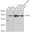 Zinc Finger Protein 195 antibody, A12046, Boster Biological Technology, Western Blot image 