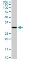 Parkin coregulated gene protein antibody, H00135138-D01P, Novus Biologicals, Western Blot image 