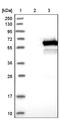 DEP Domain Containing 7 antibody, NBP1-86068, Novus Biologicals, Western Blot image 