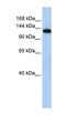 Myosin Binding Protein C, Fast Type antibody, orb330225, Biorbyt, Western Blot image 