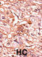 Cell Division Cycle 25B antibody, abx031845, Abbexa, Immunohistochemistry paraffin image 