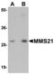 NSE2 (MMS21) Homolog, SMC5-SMC6 Complex SUMO Ligase antibody, LS-C115838, Lifespan Biosciences, Western Blot image 