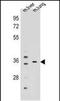 Potassium Channel Regulator antibody, PA5-48296, Invitrogen Antibodies, Western Blot image 