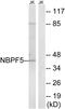 Neuroblastoma breakpoint family member 5 antibody, PA5-39294, Invitrogen Antibodies, Western Blot image 