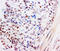 Glucocorticoid receptor antibody, AP23379PU-N, Origene, Immunohistochemistry paraffin image 