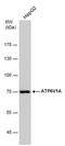 ATPase H+ Transporting V1 Subunit A antibody, MA5-27730, Invitrogen Antibodies, Western Blot image 