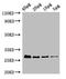 Ribosomal Protein S2 antibody, LS-C211790, Lifespan Biosciences, Western Blot image 