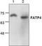 Long-chain fatty acid transport protein 4 antibody, TA318895, Origene, Western Blot image 
