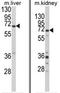 Enoyl-CoA Hydratase And 3-Hydroxyacyl CoA Dehydrogenase antibody, AP18003PU-N, Origene, Western Blot image 