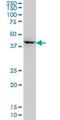 Homeobox protein DLX-2 antibody, ab117546, Abcam, Western Blot image 