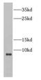 Centromere Protein W antibody, FNab01127, FineTest, Western Blot image 
