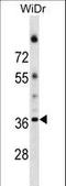 ALG5 Dolichyl-Phosphate Beta-Glucosyltransferase antibody, LS-C161040, Lifespan Biosciences, Western Blot image 