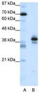 Paired Like Homeodomain 1 antibody, TA335812, Origene, Western Blot image 