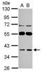 LanC Like 1 antibody, GTX118030, GeneTex, Western Blot image 