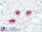 Mitogen-Activated Protein Kinase Kinase Kinase 5 antibody, LS-B7565, Lifespan Biosciences, Immunohistochemistry paraffin image 