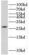 Amyloid P Component, Serum antibody, FNab07756, FineTest, Western Blot image 