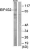 DLG Associated Protein 5 antibody, orb10532, Biorbyt, Western Blot image 