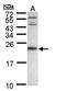 Adenine Phosphoribosyltransferase antibody, orb69685, Biorbyt, Western Blot image 