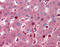 Complement component C8 beta chain antibody, 29-967, ProSci, Immunohistochemistry paraffin image 