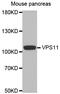 Vacuolar protein sorting-associated protein 11 homolog antibody, A05575, Boster Biological Technology, Western Blot image 