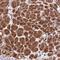 Zinc Finger Protein 565 antibody, HPA044123, Atlas Antibodies, Immunohistochemistry paraffin image 