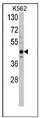 Lysine Methyltransferase 5A antibody, AP11171PU-N, Origene, Western Blot image 