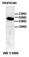 Abhydrolase Domain Containing 12B antibody, orb77641, Biorbyt, Western Blot image 