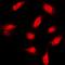 FER Tyrosine Kinase antibody, orb213925, Biorbyt, Immunocytochemistry image 