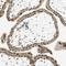 Msh Homeobox 2 antibody, HPA005652, Atlas Antibodies, Immunohistochemistry frozen image 