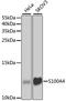 S100 Calcium Binding Protein A4 antibody, A1631, ABclonal Technology, Western Blot image 