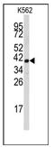 rRNA 2 -O-methyltransferase fibrillarin antibody, AP12421PU-N, Origene, Western Blot image 