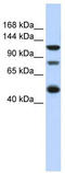 Zinc Finger E-Box Binding Homeobox 2 antibody, TA343754, Origene, Western Blot image 
