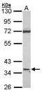 Antigen-presenting glycoprotein CD1d antibody, PA5-21625, Invitrogen Antibodies, Western Blot image 