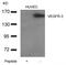 Fms Related Tyrosine Kinase 4 antibody, GTX50694, GeneTex, Western Blot image 