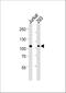 MAGE Family Member D1 antibody, M05037, Boster Biological Technology, Western Blot image 