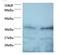 Secretory Carrier Membrane Protein 3 antibody, LS-C211819, Lifespan Biosciences, Western Blot image 