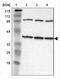 Isocitrate Dehydrogenase (NAD(+)) 3 Gamma antibody, NBP1-85824, Novus Biologicals, Western Blot image 