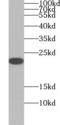 O-6-Methylguanine-DNA Methyltransferase antibody, FNab05169, FineTest, Western Blot image 