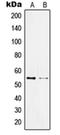 Kruppel Like Factor 11 antibody, orb214788, Biorbyt, Western Blot image 