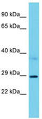 Ribosomal RNA Processing 15 Homolog antibody, TA331932, Origene, Western Blot image 