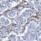 Phosphoglucomutase 2 antibody, HPA040676, Atlas Antibodies, Immunohistochemistry frozen image 