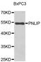 Pancreatic Lipase antibody, LS-C349125, Lifespan Biosciences, Western Blot image 