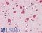Serologically Defined Colon Cancer Antigen 8 antibody, LS-B10345, Lifespan Biosciences, Immunohistochemistry paraffin image 